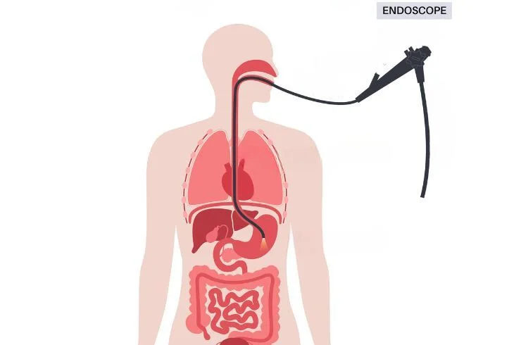 scopedigestiveclinic Endoscopy